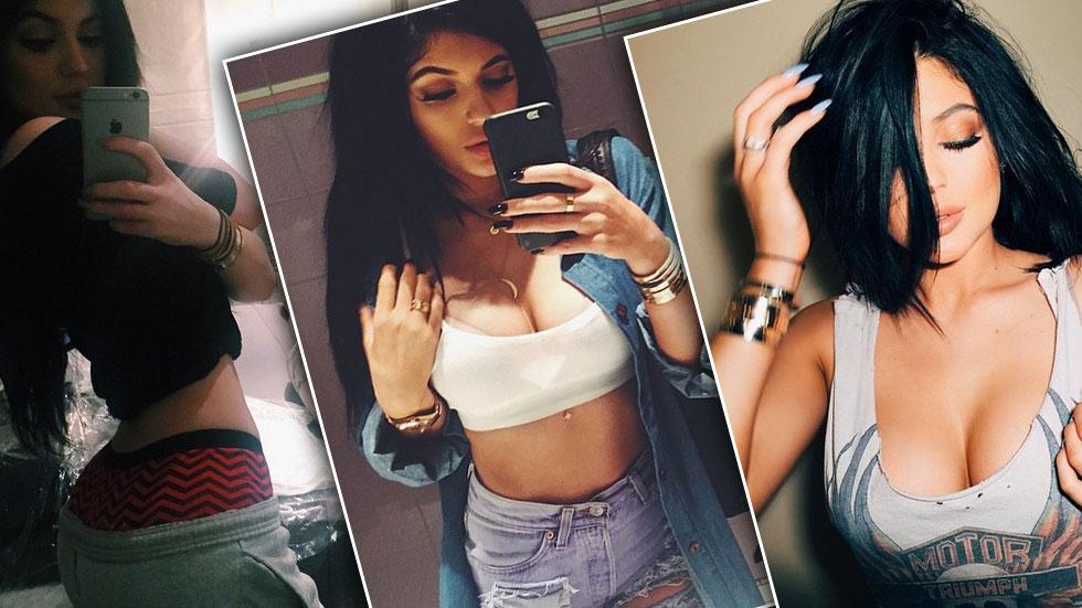 Exclusive: Did Kylie Jenner Get Plastic Surgery In A Quest To Become The Ho...