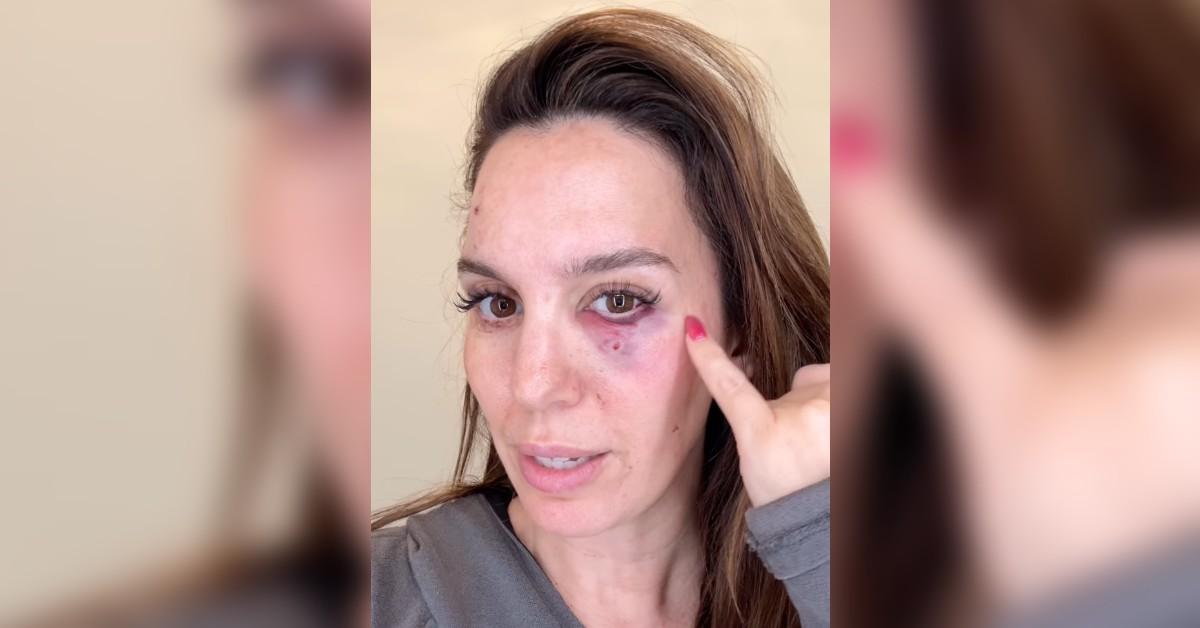 christy carlson romano life flash before eyes shot accident watch