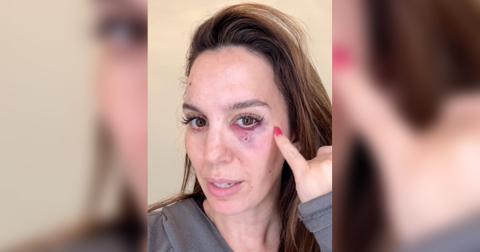 Christy Carlson Romano Reveals She Was Shot During Accident: Watch