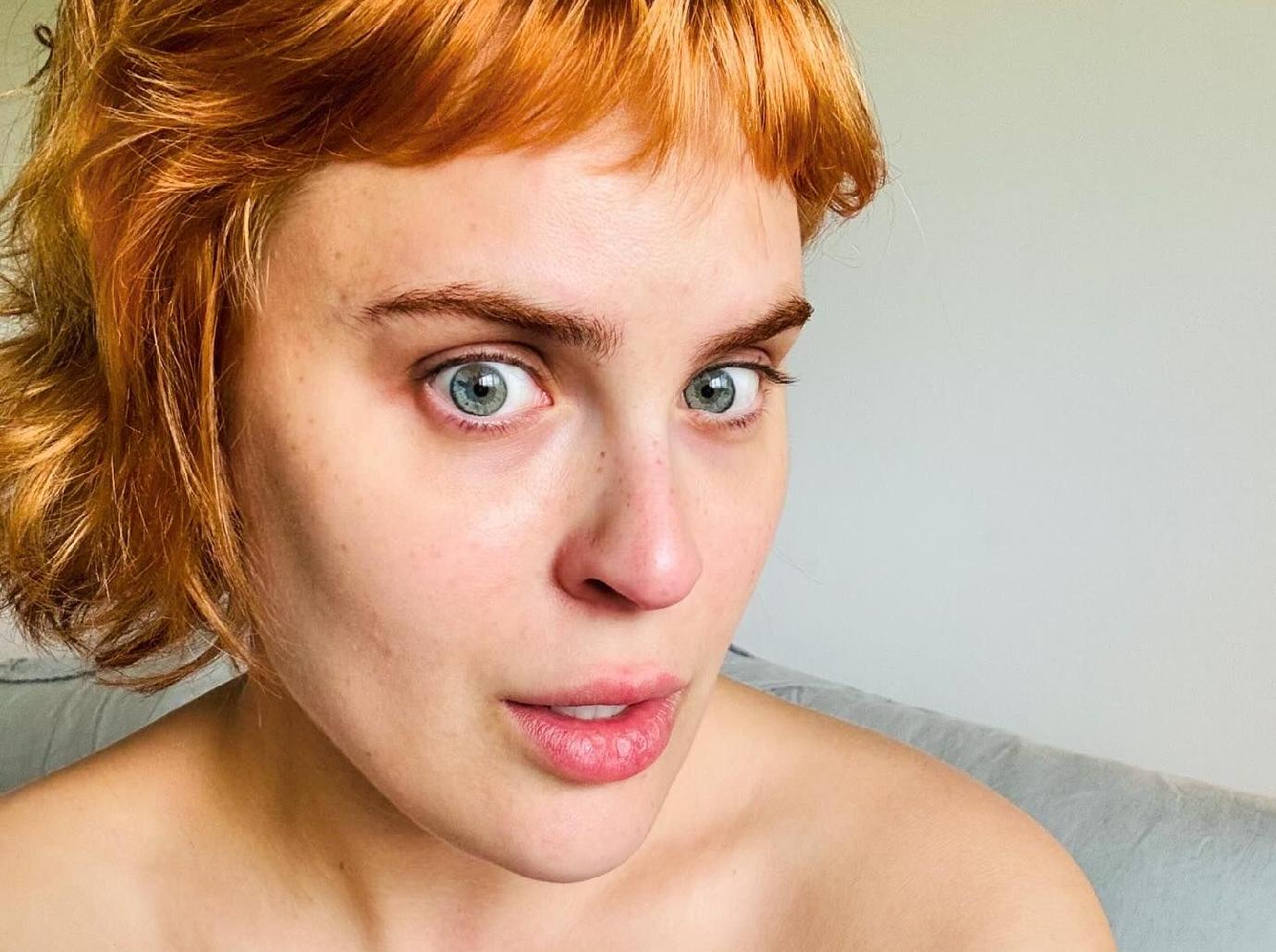 tallulah willis real bone structure face filler disolved photos