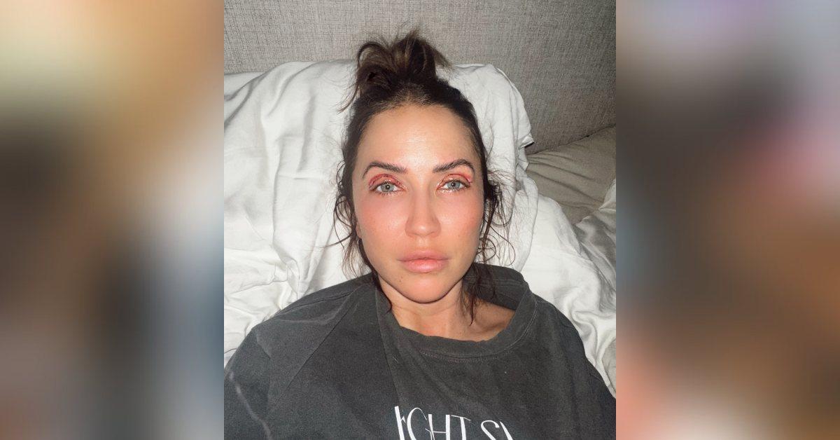 kaitlyn bristowe upper eyelid plastic surgery photos