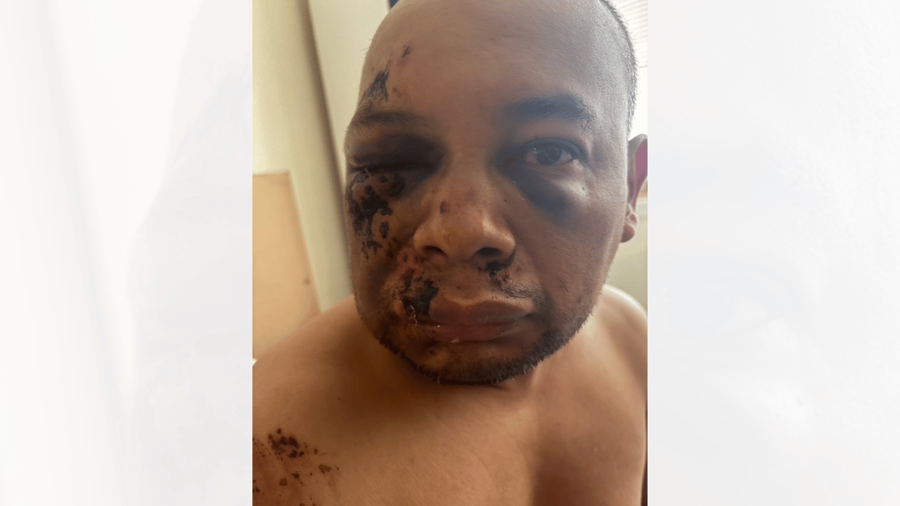 Image of Mejia Hernandez reportedly returned to the hospital as his condition worsened.