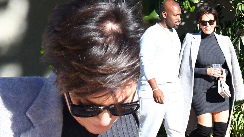 Kris jenner bald spot