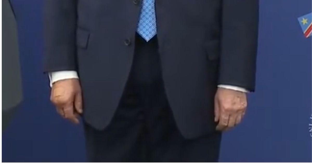 image of Donald Trump’s hand looked bruised during a recent event.