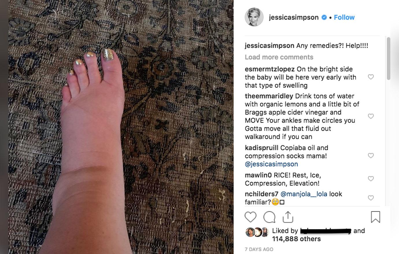 Jessica Simpson’s 10Year Challenge Makes Fun Of Swollen Pregnancy Foot