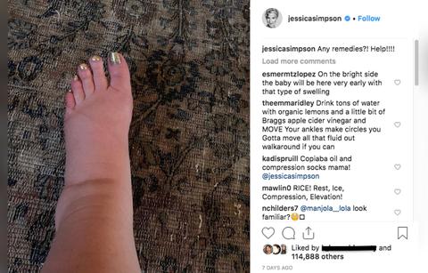 Jessica Simpson’s 10-Year Challenge Makes Fun Of Swollen Pregnancy Foot