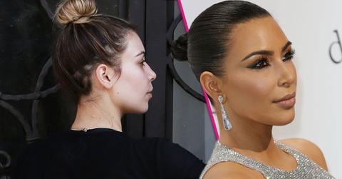 Kim kardashian hairline surgery HERO