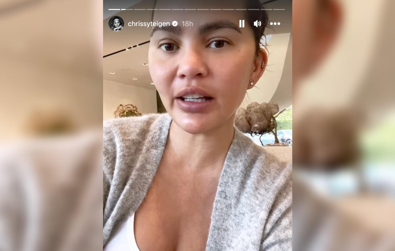 Chrissy Teigen Nip Slip at the Super Bowl; Chrissy Teigen Twitter  Reactions;