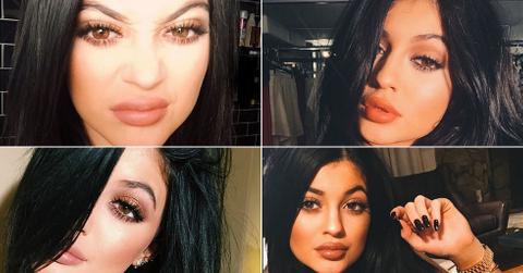 Kylie Jenner Plastic Surgery