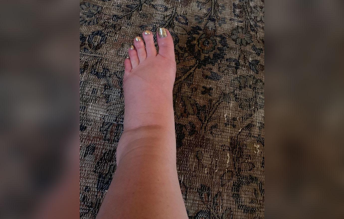 Jessica Simpson Shows Off Swollen Ankles