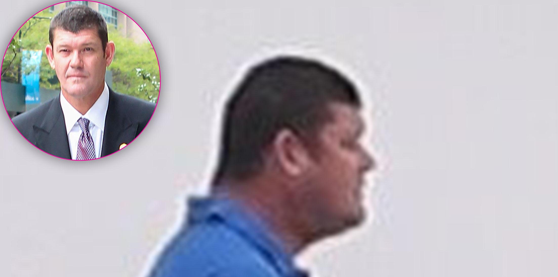 james packer weight loss