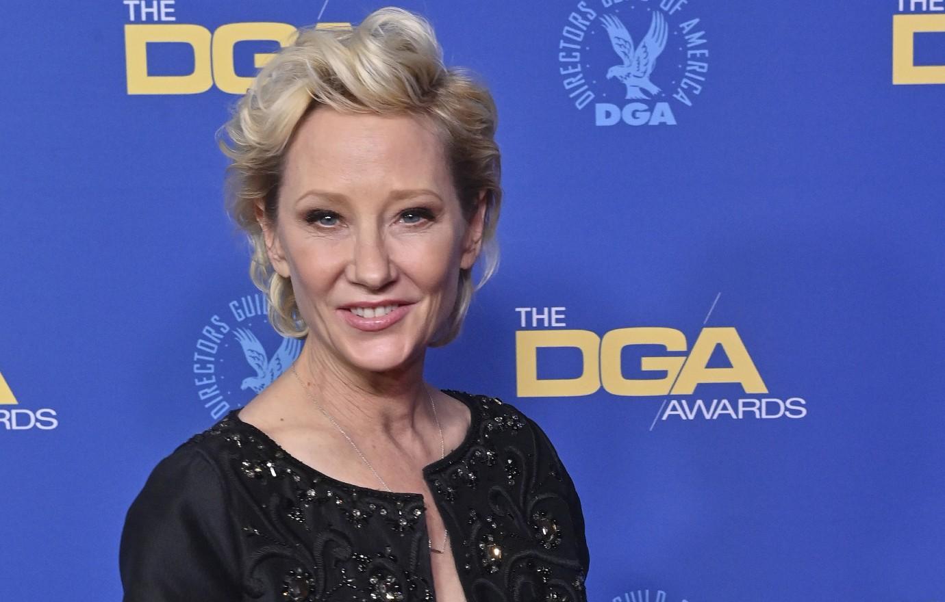 anne heche hospitalized severe burns fiery car crash