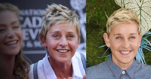 Ellen DeGenerges' Plastic Surgery Secrets Revealed