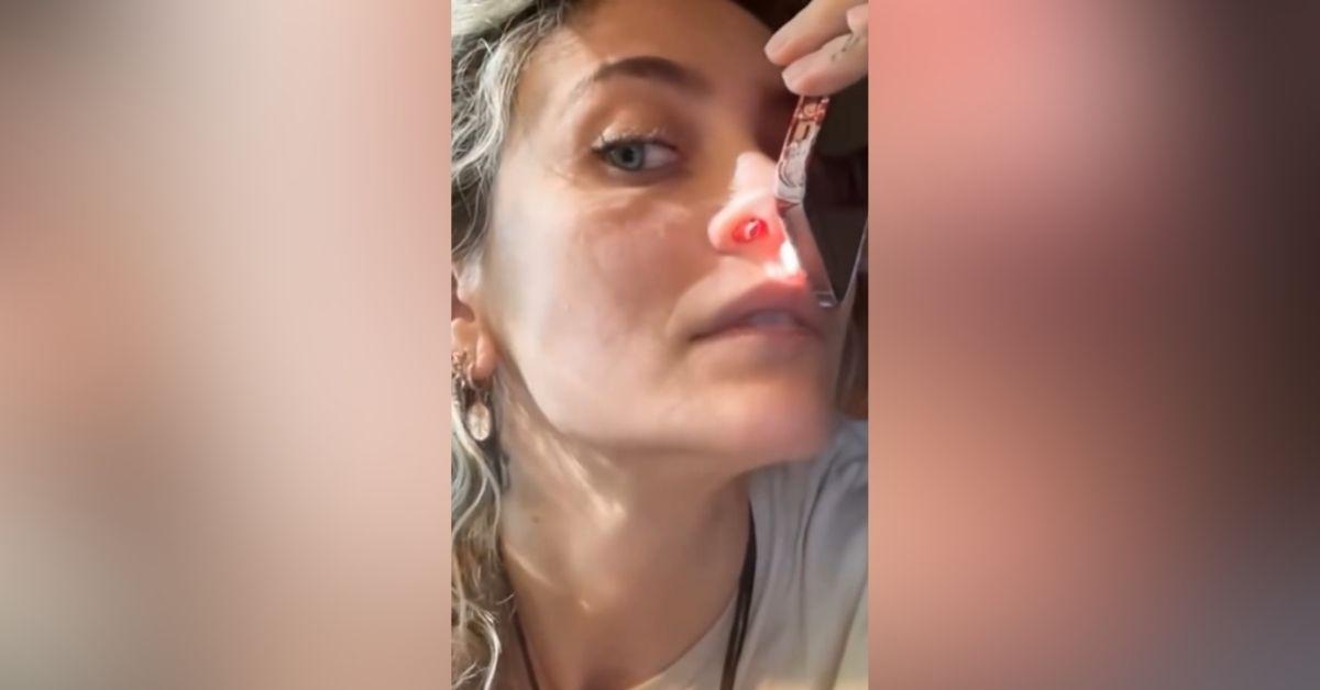 image of Paris Jackson revealed she has a perforated septum from past drug use.