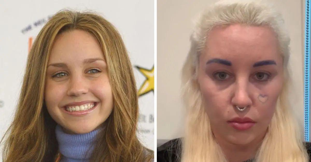 amanda bynes ozempic look better pictures lose double chin
