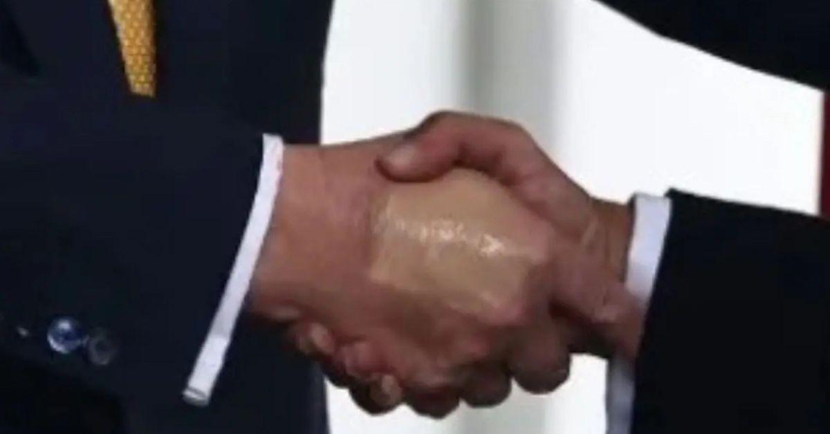 photo of The president has chosen to cover his bruised hand with makeup