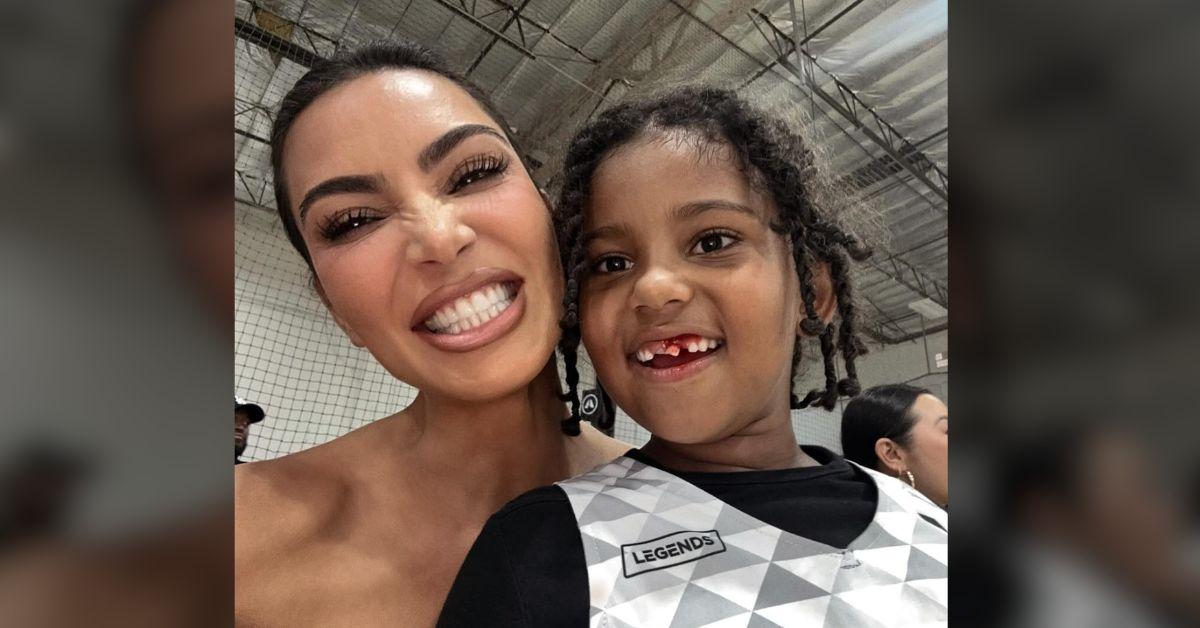 Image of Kim Kardashian's kids are losing their baby teeth.