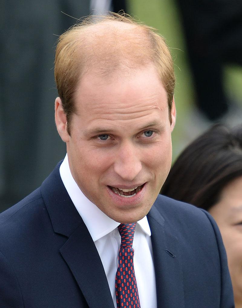 Prince william balding 03