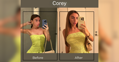 the case for the cosmetic twins alexa corey arnowitz embrace empowerment through surgery