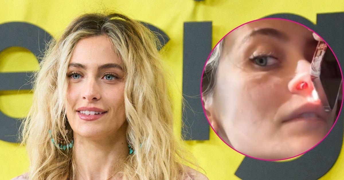 paris jackson perforated septum