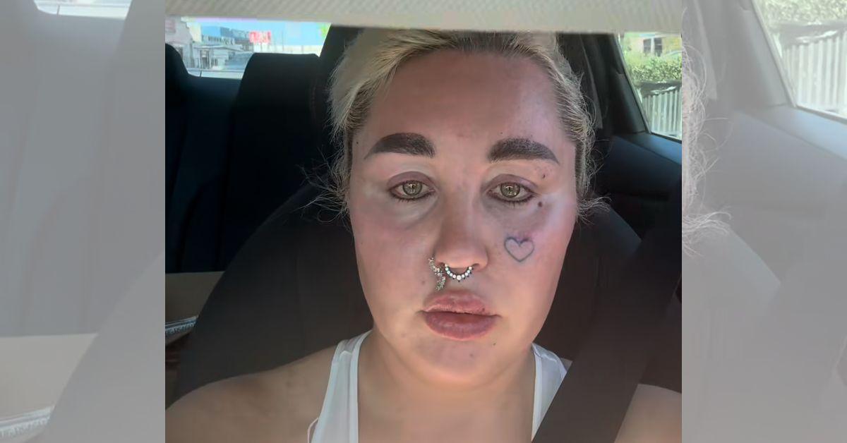 photo of Amanda Bynes debuted her lip injections on Friday, August 22