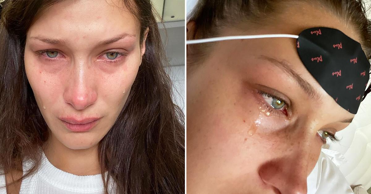 Bella Hadid Shares Crying Selfies In Mental Illness Post