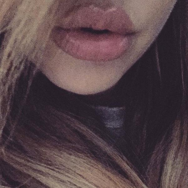 Khloe kardashian lips