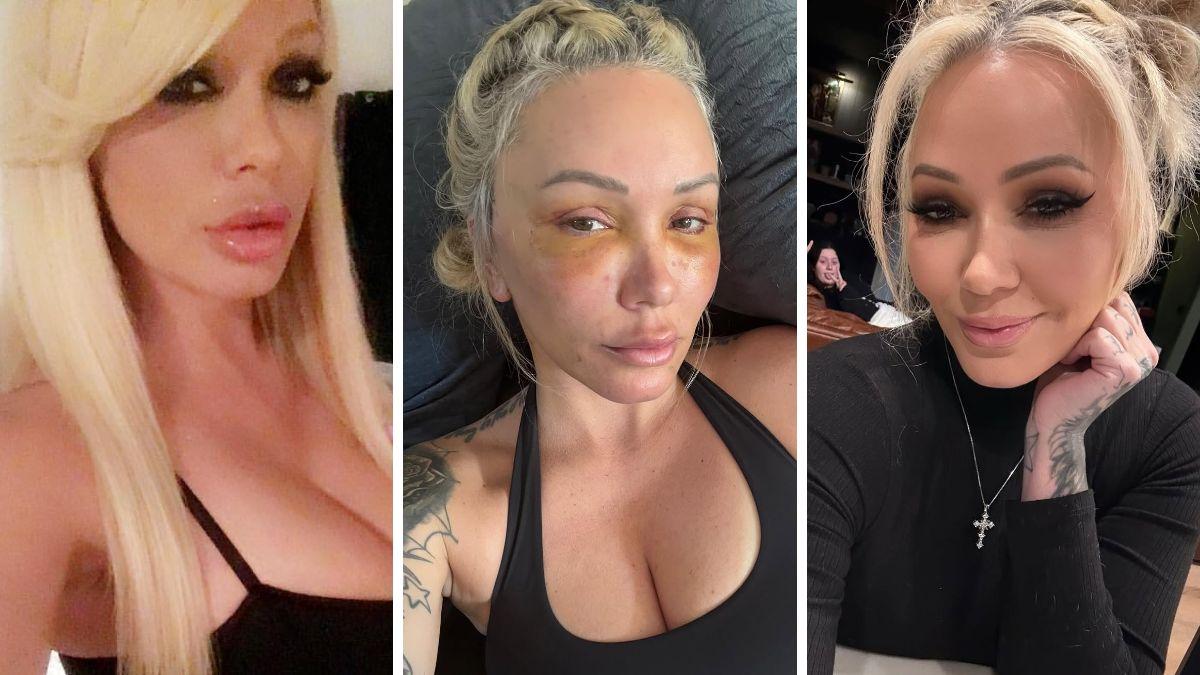bunnie xo dramatic transformation before after photos