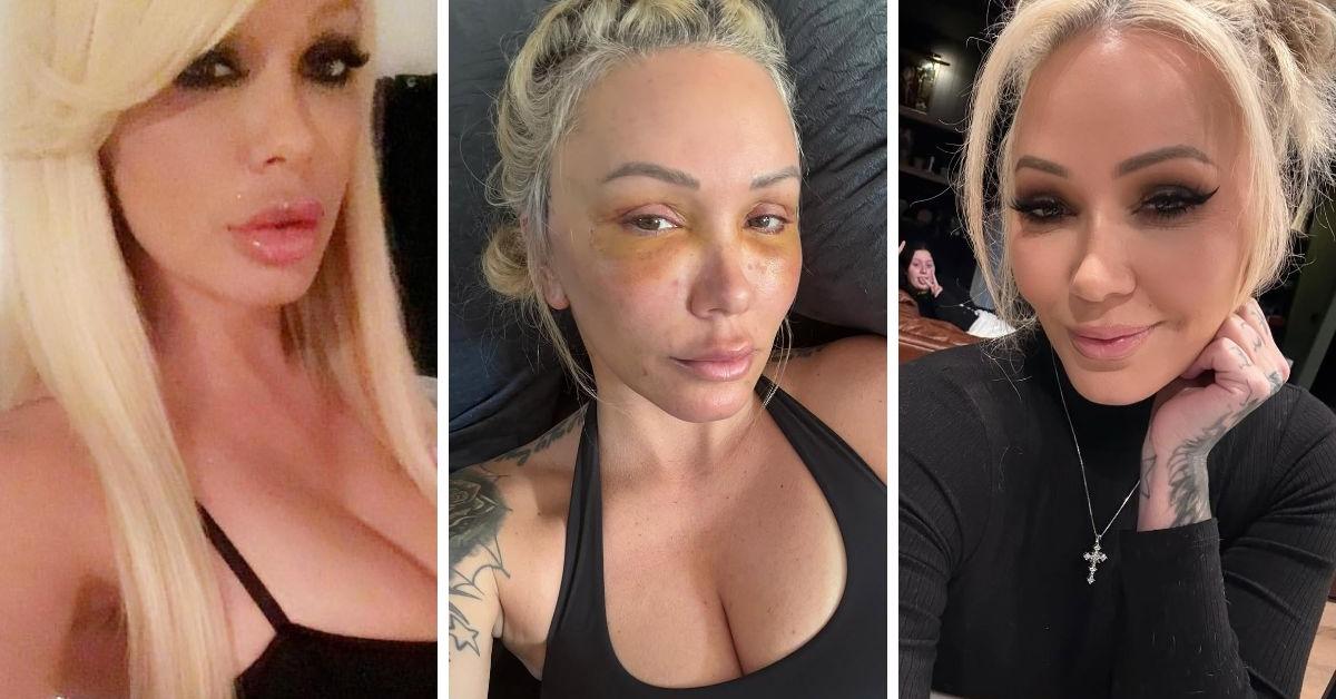 Bunnie Xo's Dramatic Transformation Over the Years: See Before and After Photos