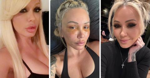 bunnie xo dramatic transformation before after photos