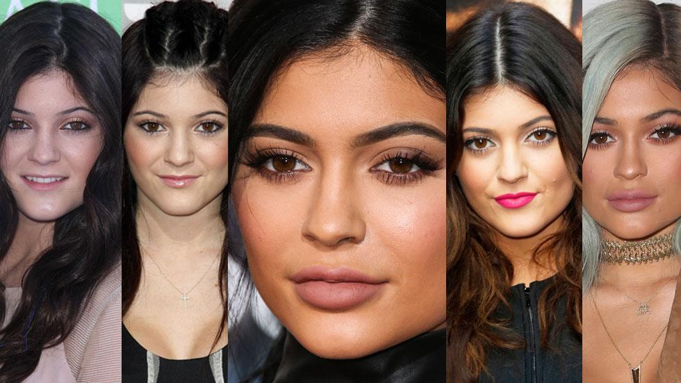 Kylie Jenners Face Transformation In Photos See Her New Face That Shocked Everyone