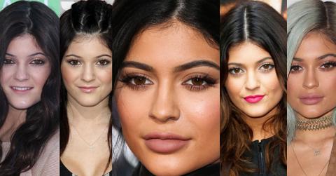 Kylie Jenner Face Change Transformation Lips Surgery