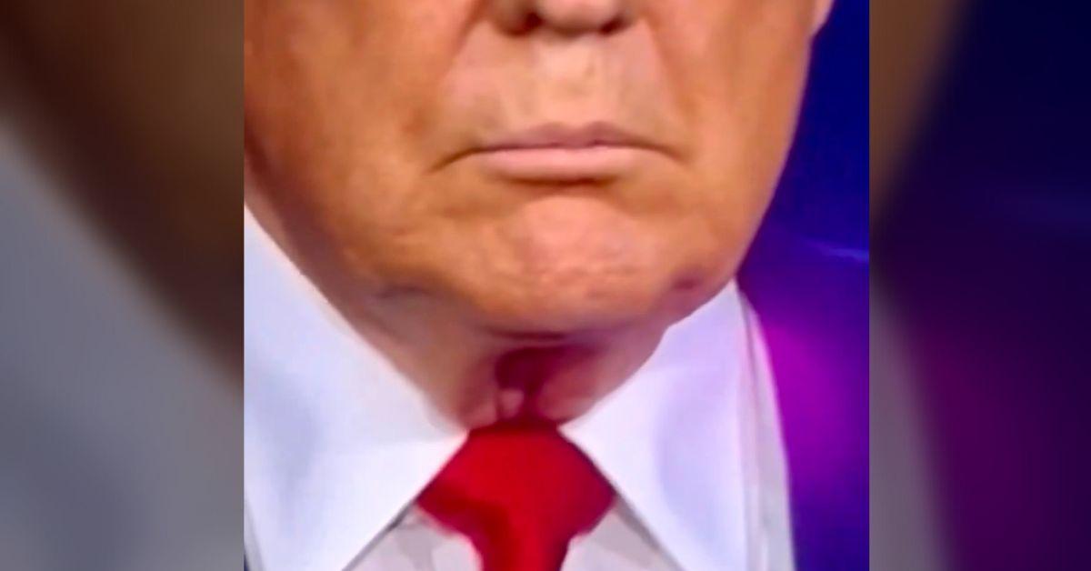 donald trump sagging neck