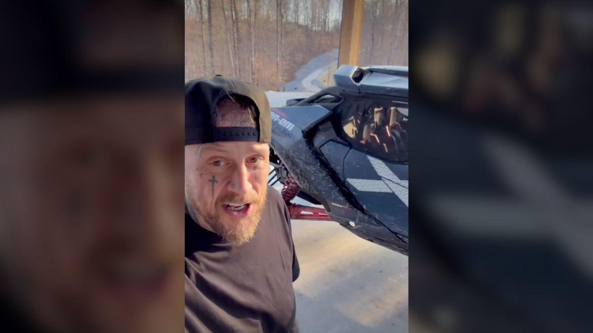 image of Jelly Roll said every congratulatory hug at the ceremony left him in pain.