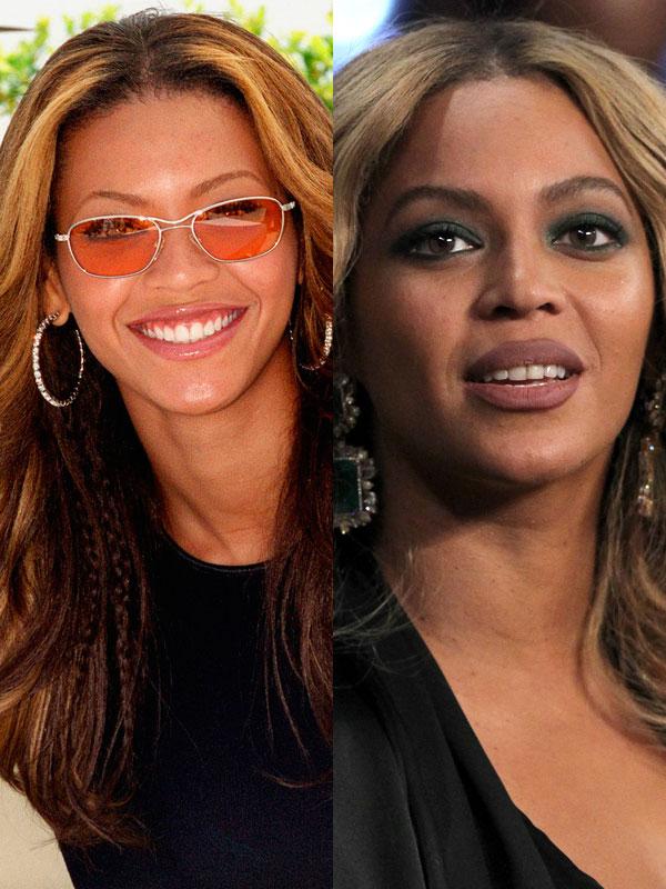 Kevin federline beyonce botox