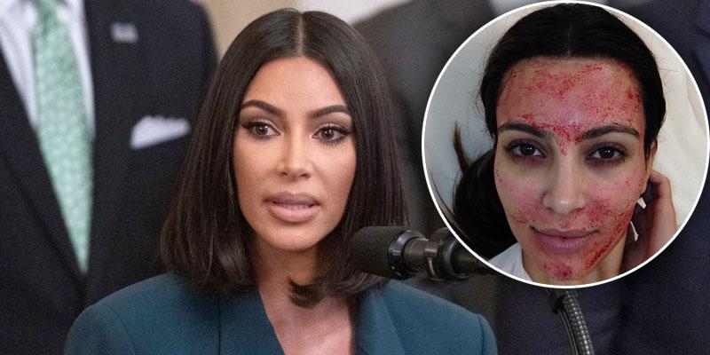 Kim Kardashian Sues Alabama Doctor Over Iconic Vampire Facial