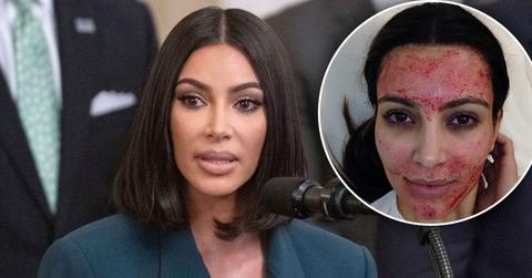 Kim Kardashian Sues Alabama Doctor Over Iconic Vampire Facial