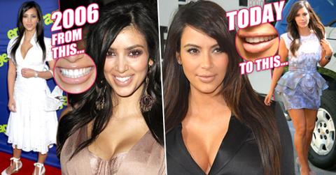 transformed by surgery kim kardashian nip tuck obsession exposed