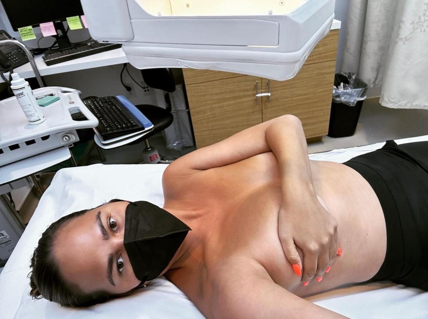 chrissy teigen topless mammogram ultrasound photo