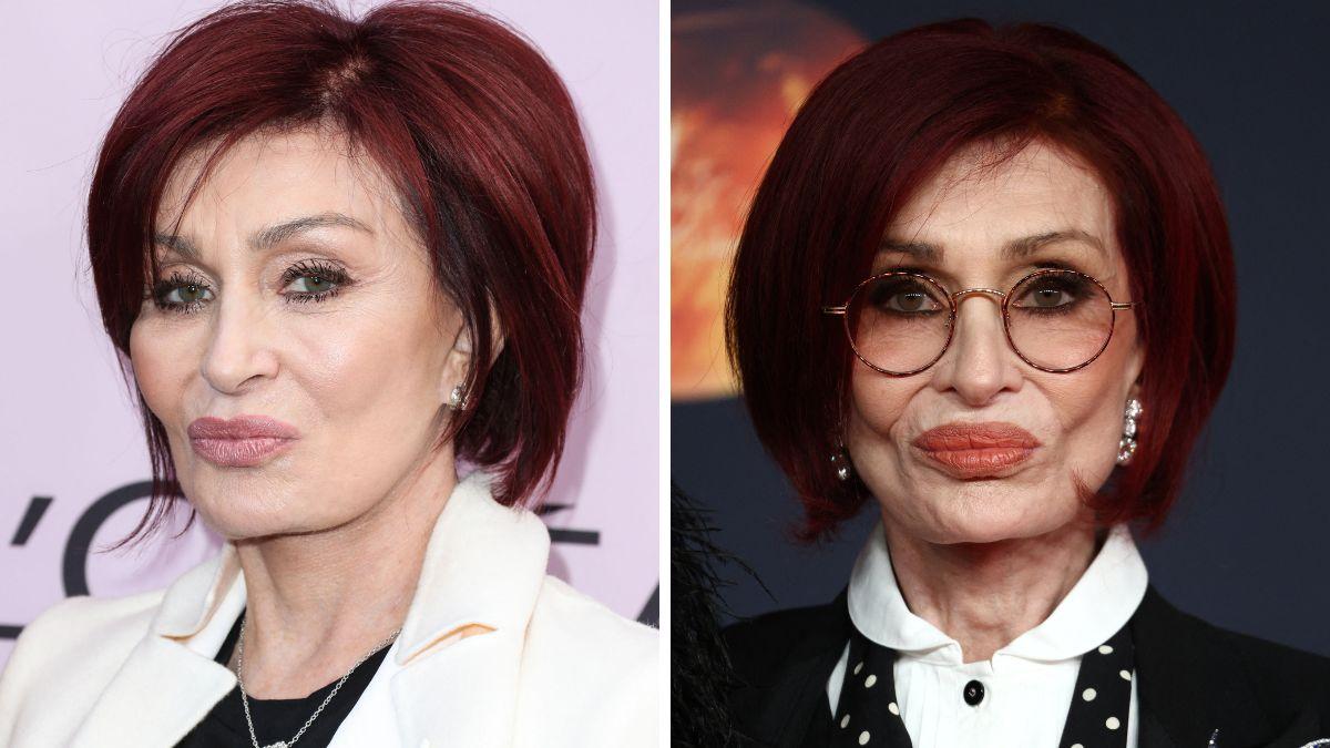 celebrities who got facelifts before after photos