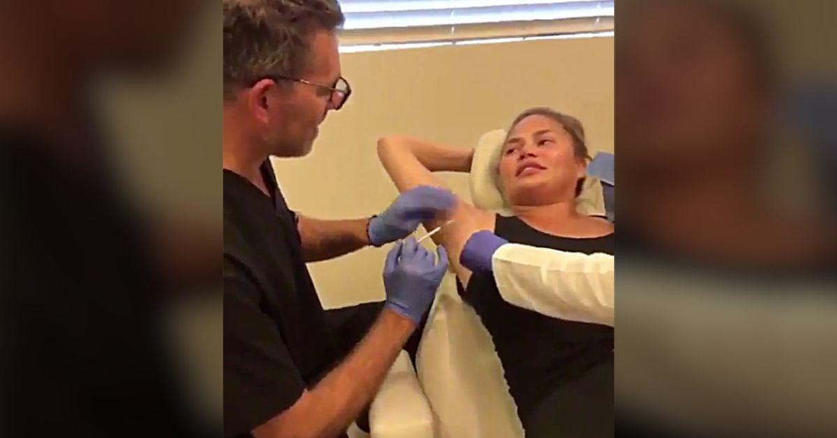 chrissy teigen health concerns alarming selfie bandaged face