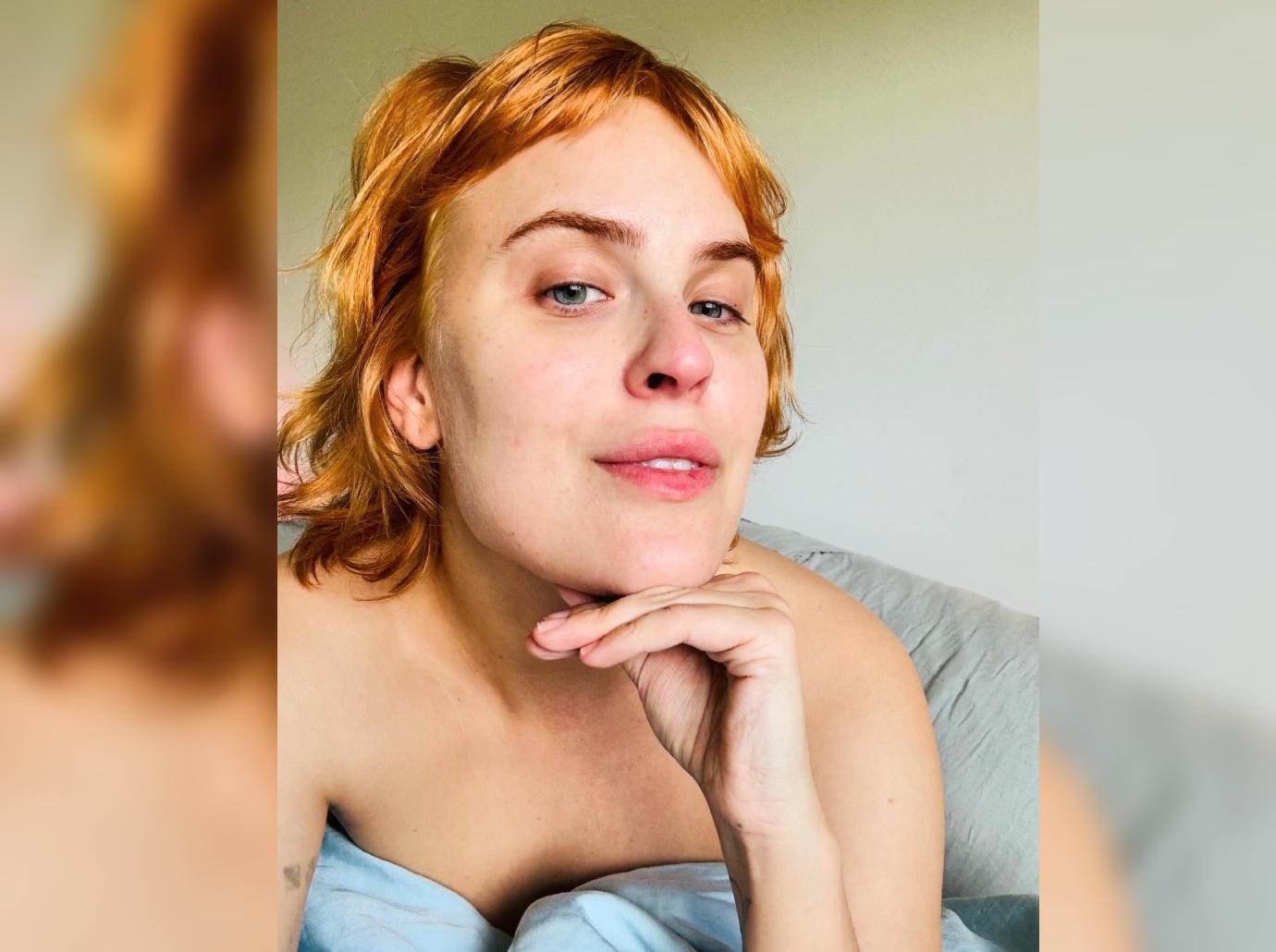 tallulah willis real bone structure face filler disolved photos