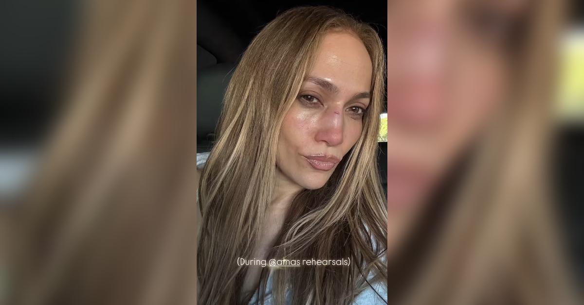 jennifer lopez stitches injury american music awards rehearsal photos