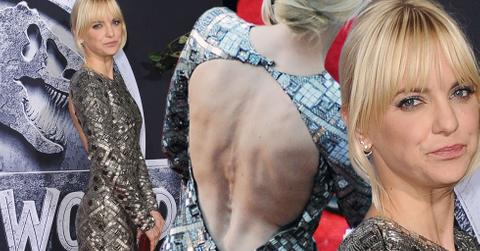 Anna faris scary skinny weight loss chris pratt anorexic