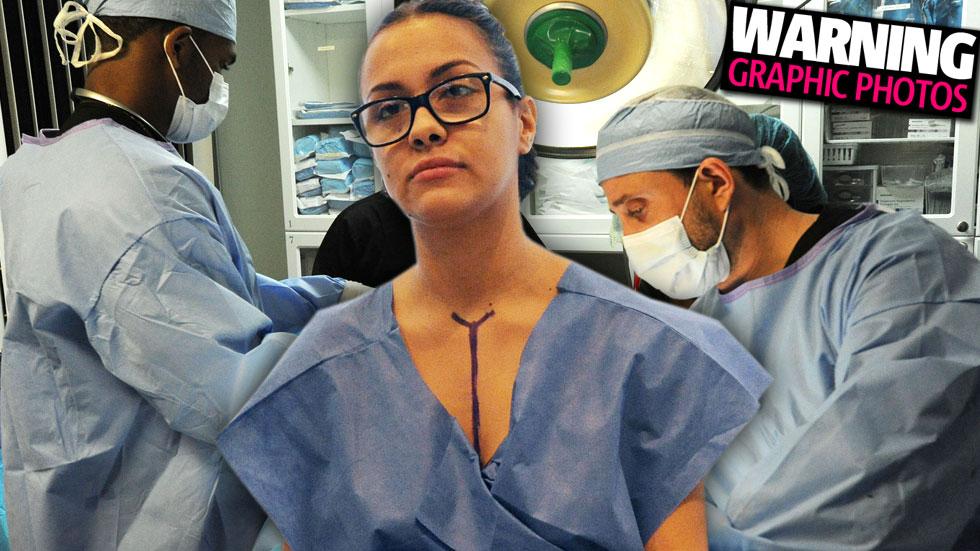 Teen Mom 3 Plastic Surgery Briana Dejesus Gets Second Boob Job Butt Lift And Labiaplasty To 0134