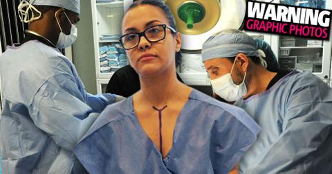 Briana DeJesus Plastic Surgery