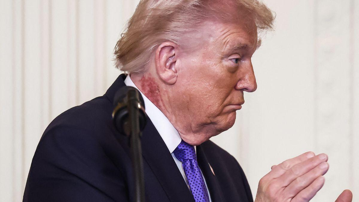 Image of The White House didn't specify what condition Donald Trump is being treated for.