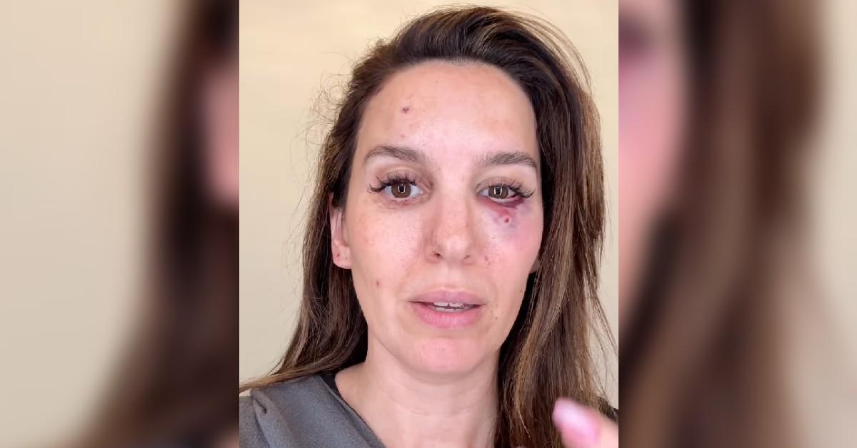 christy carlson romano life flash before eyes shot accident watch