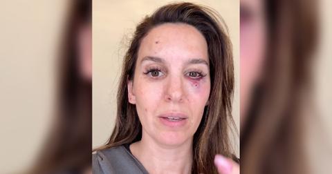 Christy Carlson Romano Reveals She Was Shot During Accident: Watch