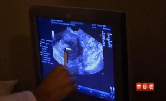 //little_couple_road_to_parenthood_video__stack_